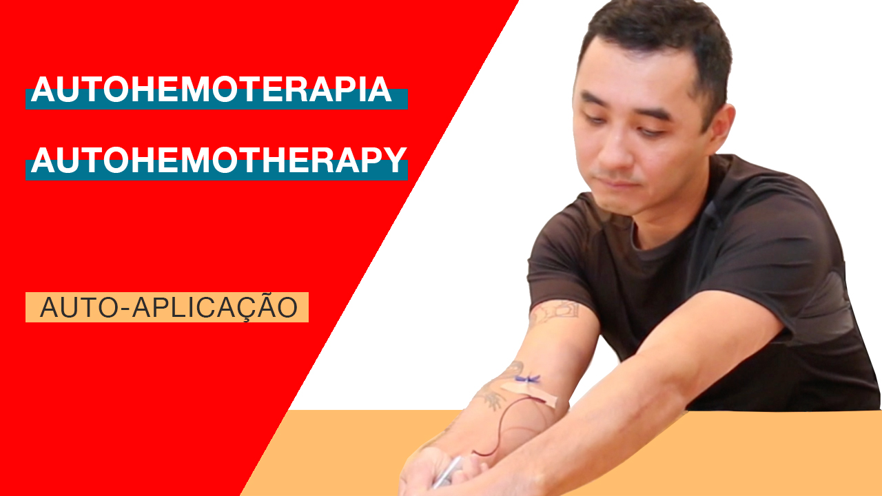 Auto-aplicação de Autohemoterapia